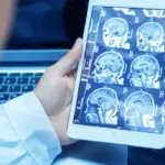 Gambar Scan Otak dan Kecerdasan